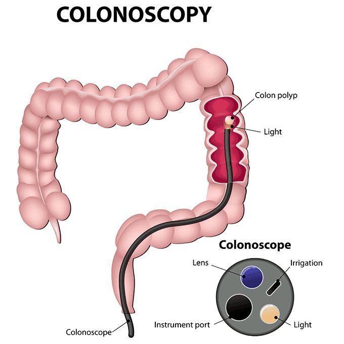diagram showing the anatomy of a colon